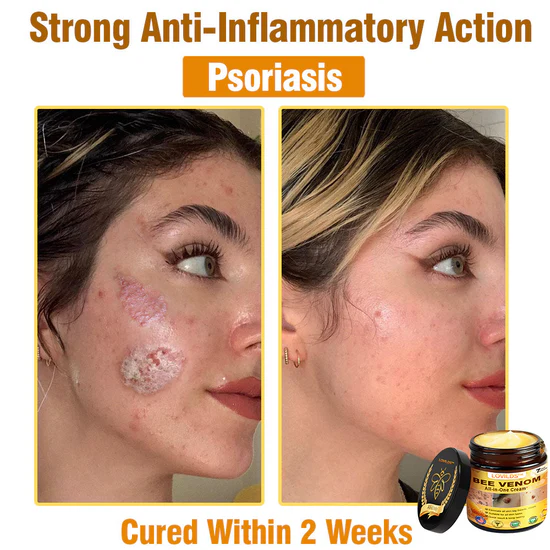 South Moon Bee Venom Pain Relief Cream for Arthritis, Muscle & Joint Discomfort (Original)