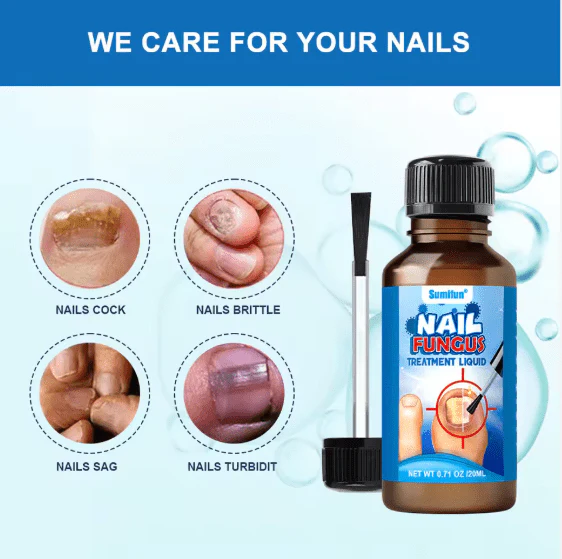 Sumifun - Nail Fungus Treatment Liquid (Original)